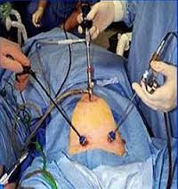 Laparoscopic Surgery Doctors
