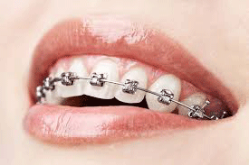 Orthodontist Doctors